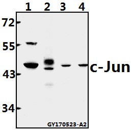 a02038 1 jun primary antiboties wb testing 1