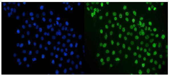 a02038 2 jun primary antibodies if testing 8
