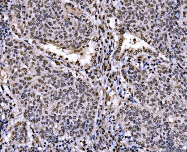  IHC analysis of c-Jun/JUN using anti-c-Jun/JUN antibody (A02038-2)