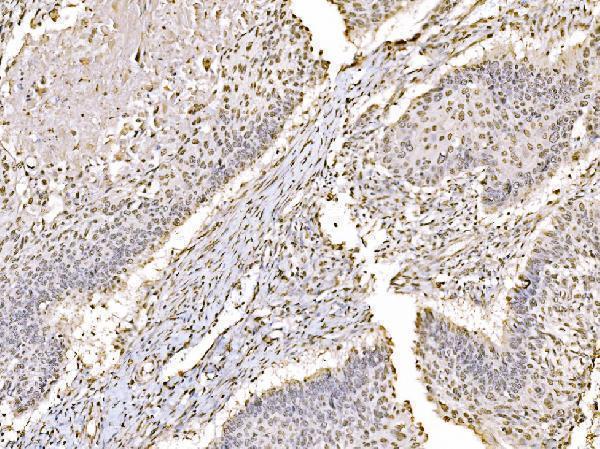  IHC analysis of c-Jun/JUN using anti-c-Jun/JUN antibody (A02038-2)