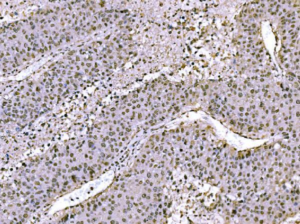 a02038 2 jun primary antibodies ihc testing 5