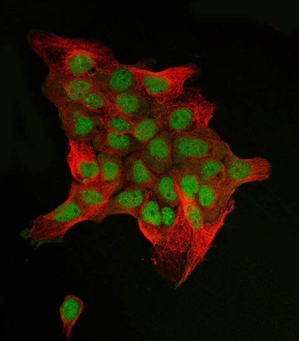 a02038 3 jun primary antibodies if testing 4