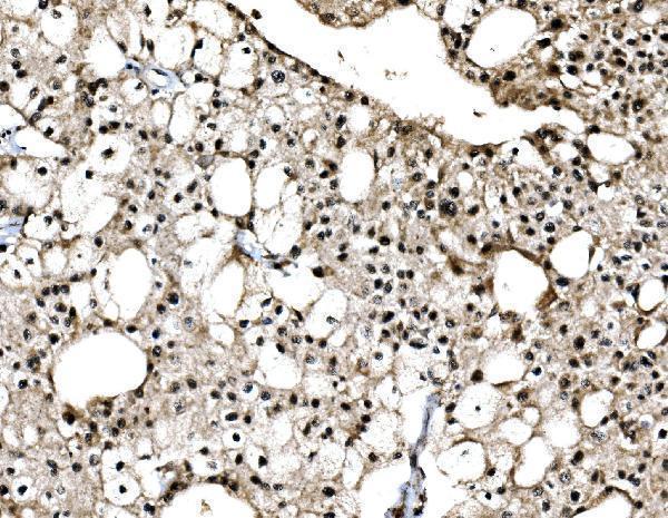  IHC analysis of C-Jun/JUN using anti-C-Jun/JUN antibody (A02038-3)