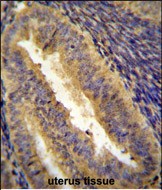 a02038 anti jun antibody c term ihc p testing 2