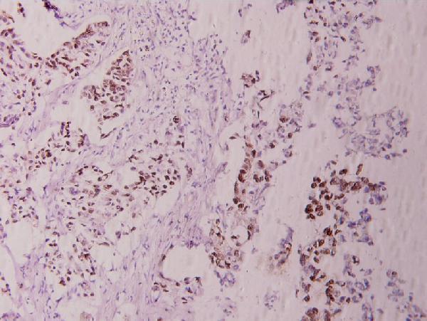 a02038s243 jun primary antiboties ihc testing 2