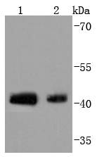 a02038s63 1 jun primary antiboties wb testing 1