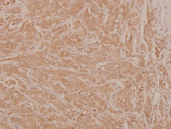 a02038s63 jun primary antiboties ihc testing 2