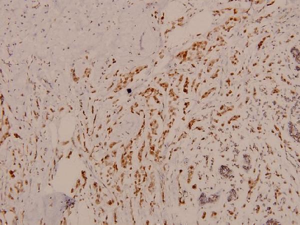 a02038s73 jun primary antiboties ihc testing 2