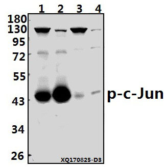 a02038s73 jun primary antiboties wb testing 1