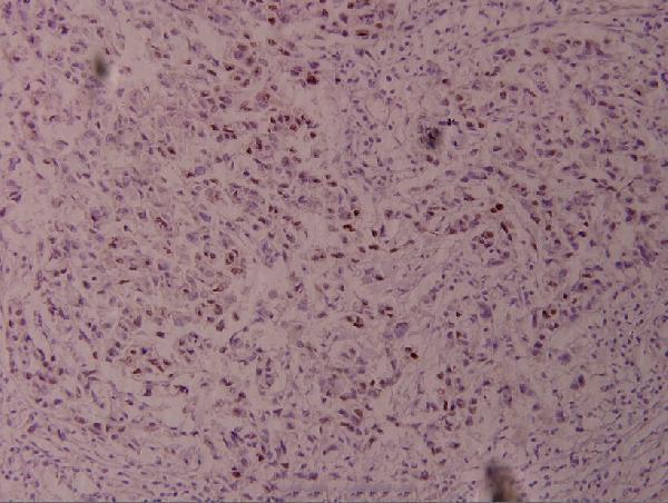 a02038t239 jun primary antiboties ihc testing 2