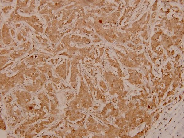 a02038t91 jun primary antiboties ihc testing 2