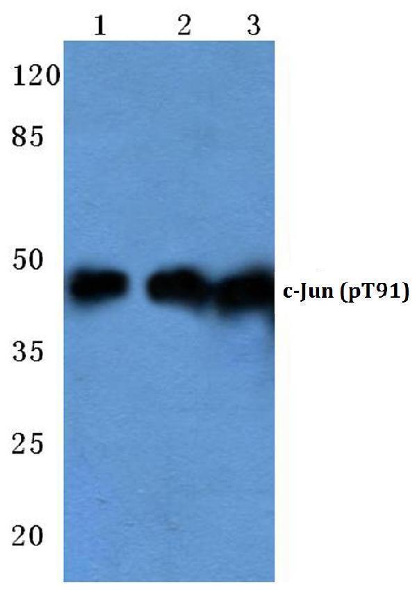a02038t91 jun primary antiboties wb testing 1