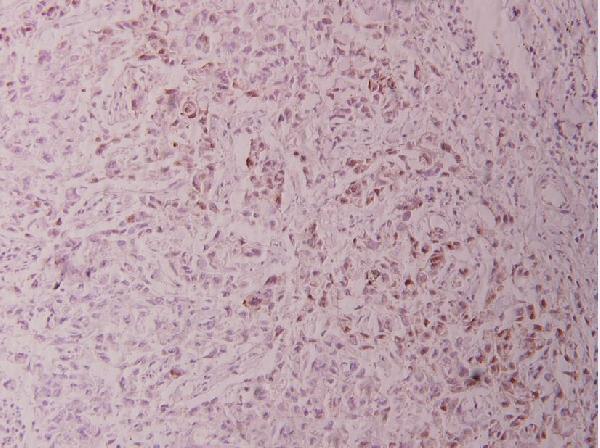a02038t93 jun primary antiboties ihc testing 2