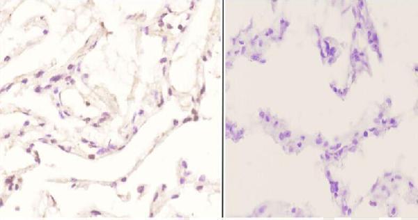 a02038y170 jun primary antiboties ihc testing 2