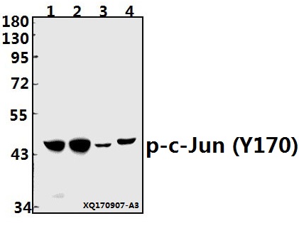 a02038y170 jun primary antiboties wb testing 1