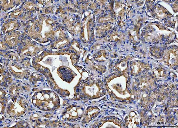  IHC analysis of TOLLIP using anti-TOLLIP antibody (A02039-1)