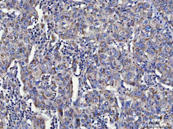  IHC analysis of TOLLIP using anti-TOLLIP antibody (A02039-1)