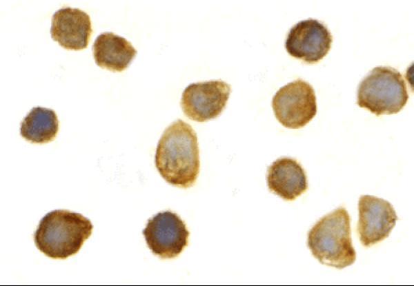 Immunocytochemistry of TOLLIP in THP-1 cells with TOLLIP antibody at 2 μg/mL