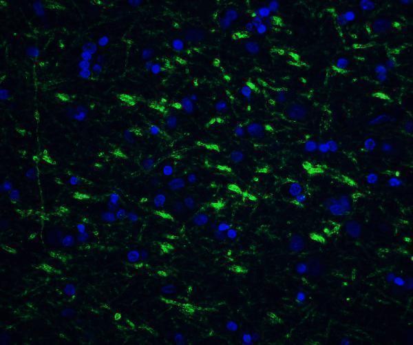 Immunofluorescence of TOLLIP in human brain tissue with TOLLIP antibody at 20 μg/ml