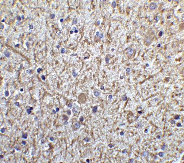 a02039 tollip primary antibodies ihc testing 4