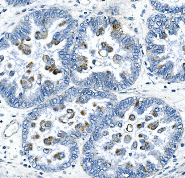 a02040 1 ccnb2 primary antibodies ihc testing 2