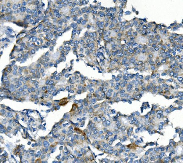 a02040 1 ccnb2 primary antibodies ihc testing 3