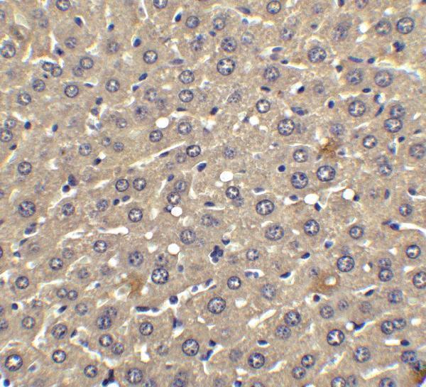 a02041 1 ifnb1 primary antibodies ihc testing 6