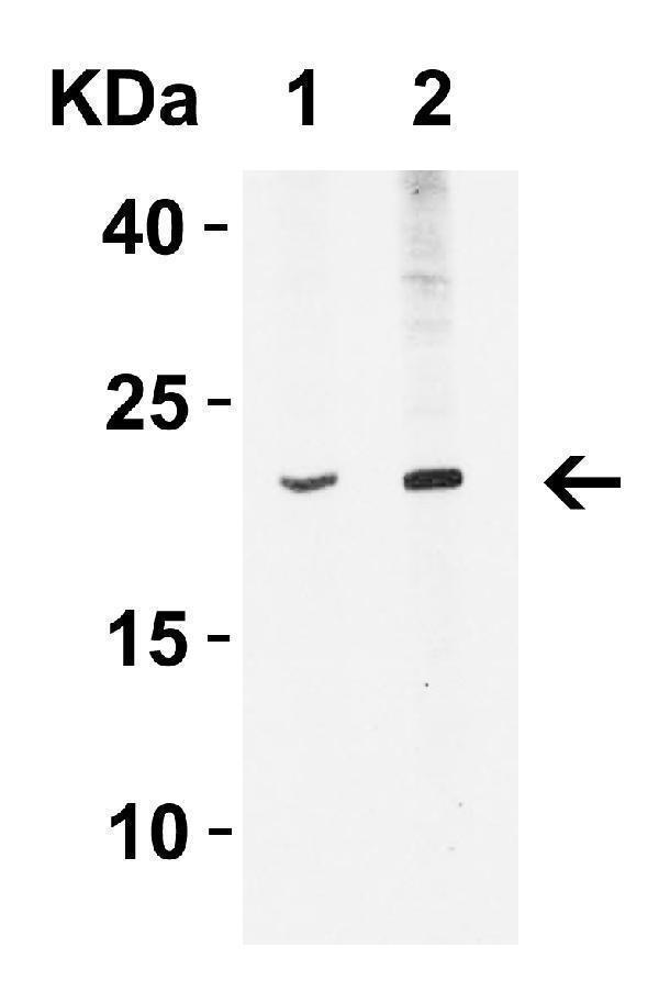 Western Blot Validation in Mouse A20 Cell Lysate
Loading: 15 μg of lysates per lane