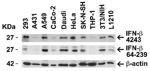Independent Antibody Validation (IAV) via Protein Expression Profile in Human and Mouse Cell Lines
Loading: 15 μg of lysates per lane
