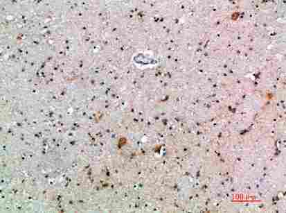 a02041 ifnb1 primary antibodyes ihc testing 1