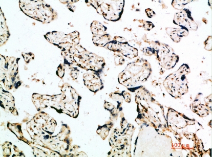 a02041 ifnb1 primary antibodyes ihc testing 2