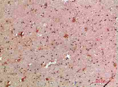 a02041 ifnb1 primary antibodyes ihc testing 3