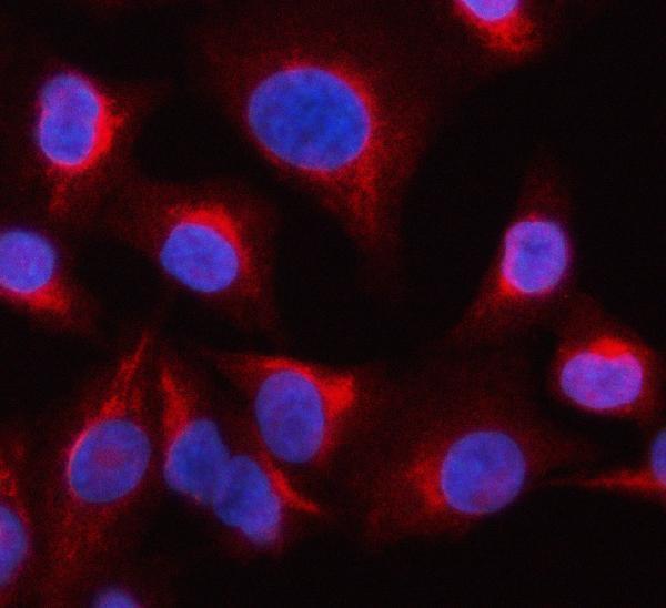 a02042 2 ocrl primary antibodies if testing 5
