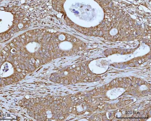  IHC analysis of OCRL using anti-OCRL antibody (A02042-2)