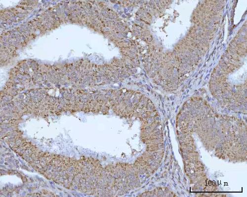  IHC analysis of OCRL using anti-OCRL antibody (A02042-2)