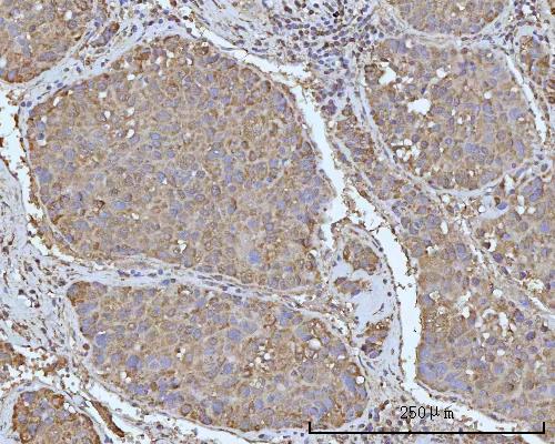 a02042 2 ocrl primary antibodies ihc testing 4