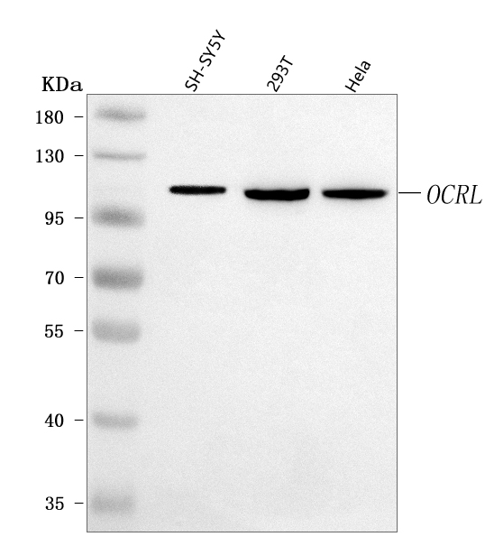  Western blot analysis of OCRL using anti-OCRL antibody (A02042-2)