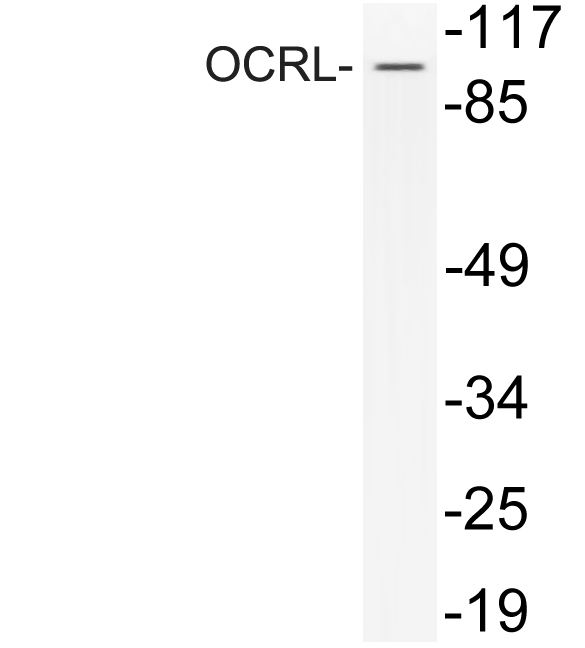 a02042 ocrl primary antibodies wb testing 1