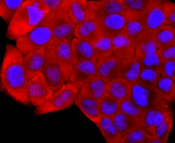 ICC staining S100 alpha 6 in Hela cells (red)