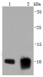 Western blot analysis of S100 alpha 6 on different lysates using anti-S100 alpha 6 antibody at 1/1,000 dilution