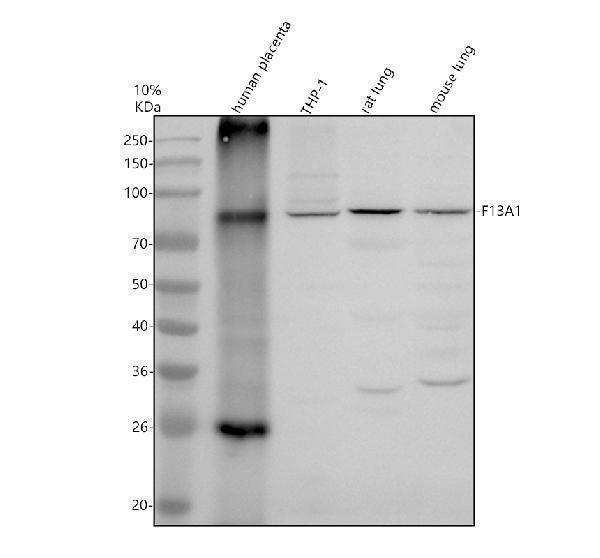 Western blot analysis of Factor XIIIa/F13A1 using anti-Factor XIIIa/F13A1 antibody (A02047-1)
