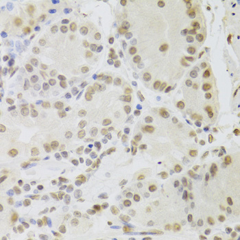 Immunohistochemistry of paraffin-embedded human stomach using RUVBL1/TIP49A/PONTIN Antibody  at dilution of 1:100 