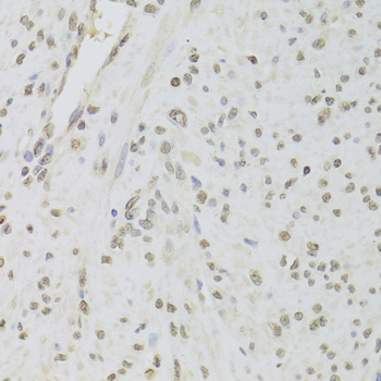 a02049 1 ruvbl1 primary antiboties ihc testing 4
