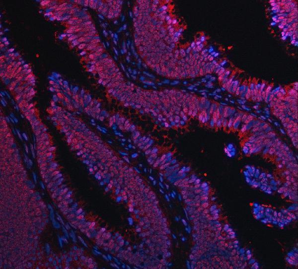 a02049 2 ruvbl1 primary antibodies if testing 9