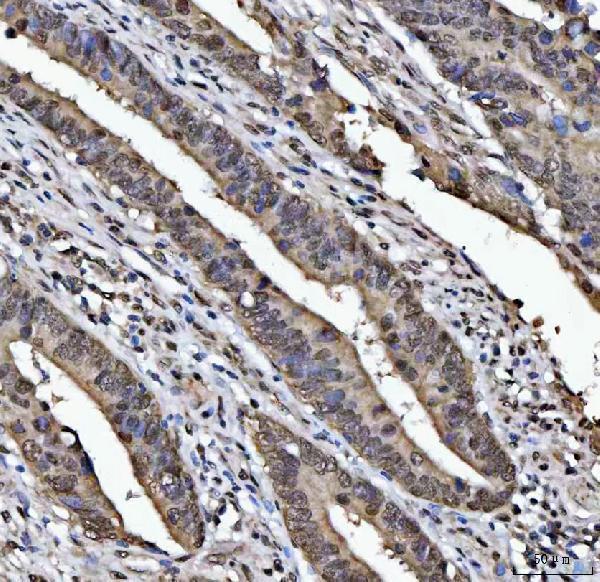  IHC analysis of TIP49A/RUVBL1 using anti-TIP49A/RUVBL1 antibody (A02049-2)
