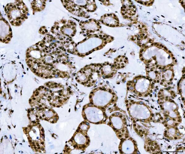  IHC analysis of TIP49A/RUVBL1 using anti-TIP49A/RUVBL1 antibody (A02049-2)