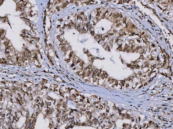 a02049 2 ruvbl1 primary antibodies ihc testing 4