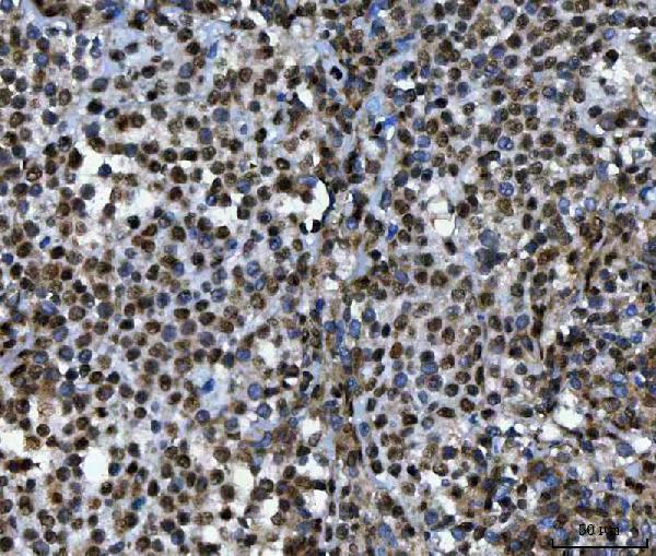 a02049 2 ruvbl1 primary antibodies ihc testing 5