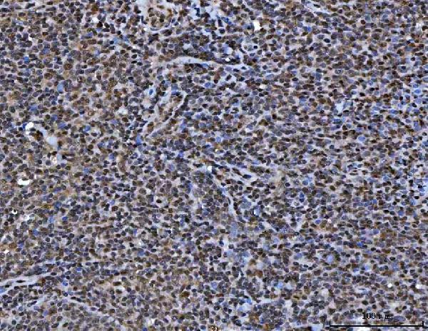 a02049 2 ruvbl1 primary antibodies ihc testing 6