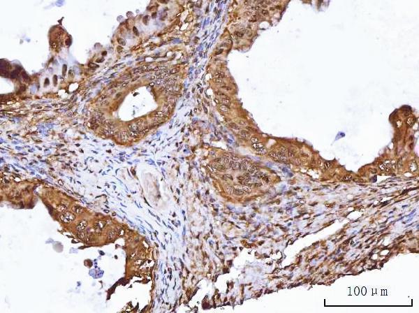 a02049 2 ruvbl1 primary antibodies ihc testing 7